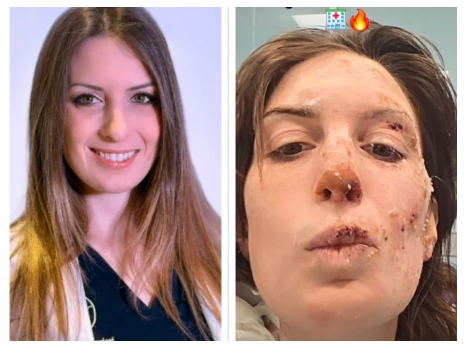 (VIDEO) Incendie de Crans-Montana : la survivante italienne témoigne et exprime sa gratitude